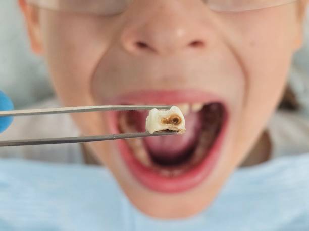 Best Broken Tooth Emergency  in Seminole, OK
